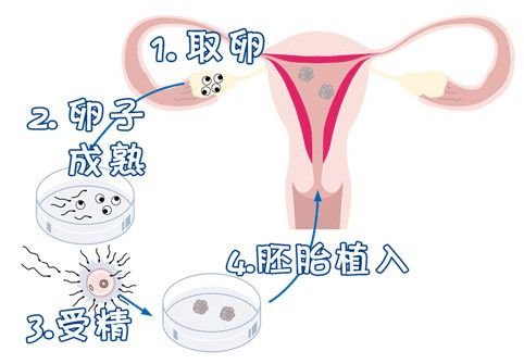 王晨光主任