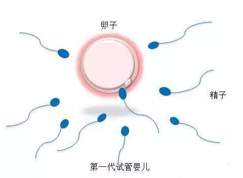 反复流产案例